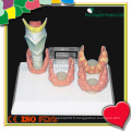 Comparaison des maladies du larynx naturel Éducation médicale Modèle anatomique